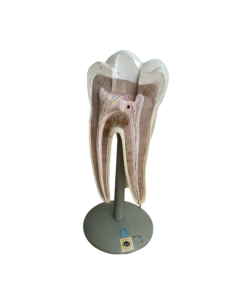 Anatomisches Lehrmodell eines Backenzahns (Molar), Längsschnitt, Deutsches Hygiene-Museum Dresden