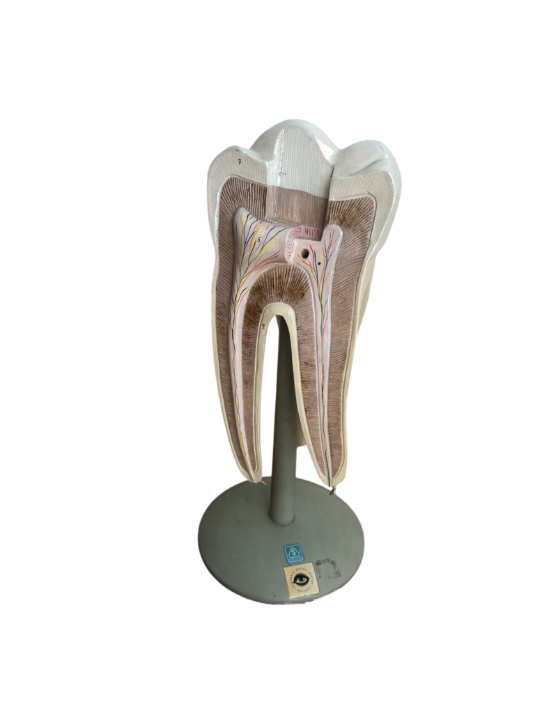 Anatomisches Lehrmodell eines Backenzahns (Molar), Längsschnitt, Deutsches Hygiene-Museum Dresden