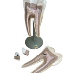 Anatomisches Lehrmodell eines Backenzahns (Molar), Demontiert mit Einzelteilen, Deutsches Hygiene-Museum Dresden