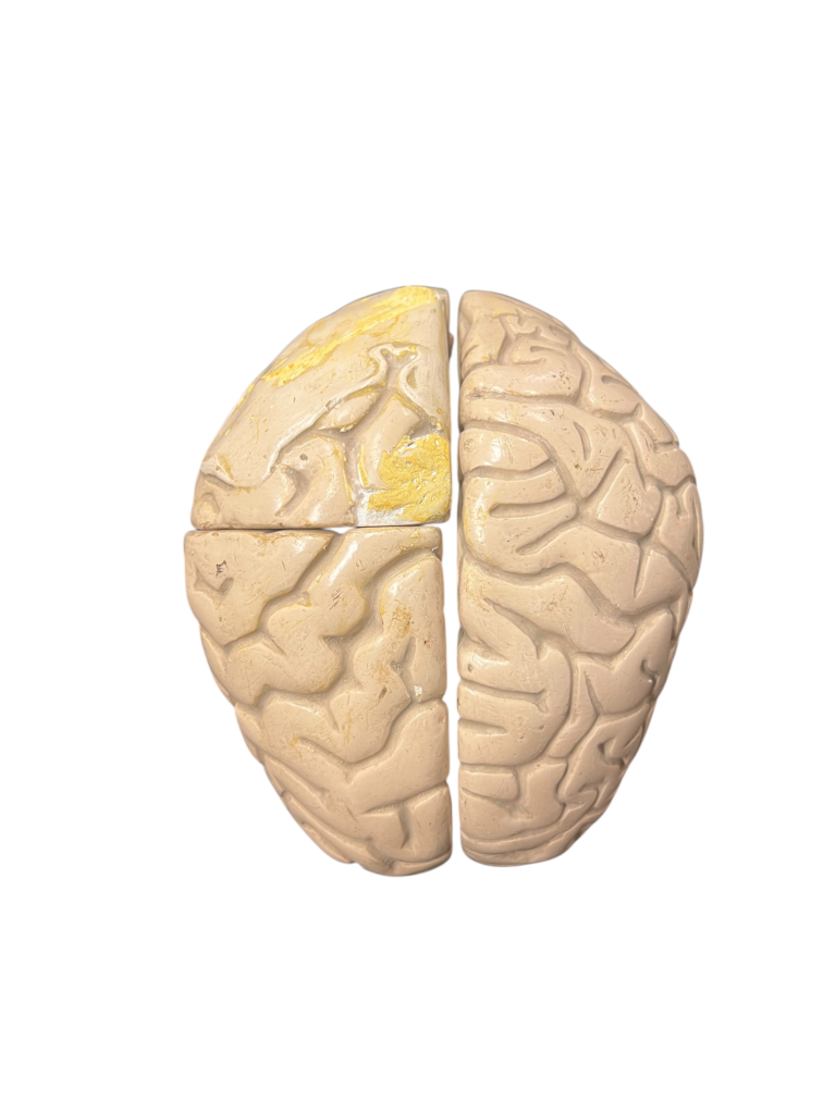Anatomisches Lehrmodell eines menschlichen Gehirns, Aufsicht